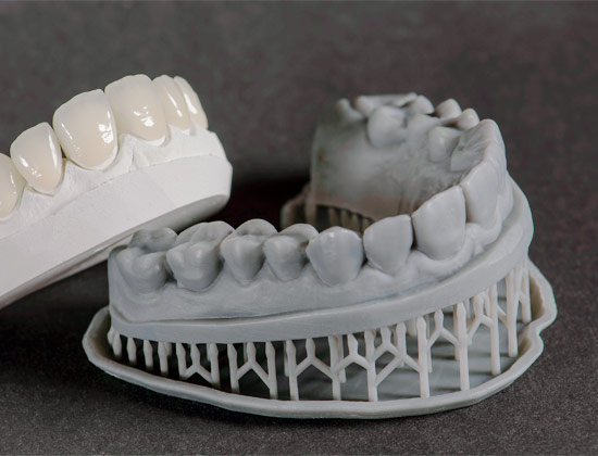 Impressão 3D