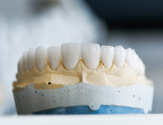 Próteses Dentárias